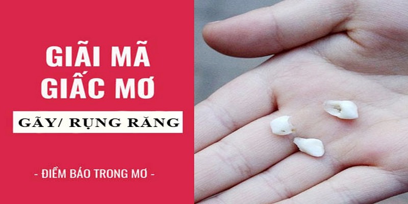 Giải Mã Giấc Mơ Thấy Rụng Răng Và Các Con Số May Mắn